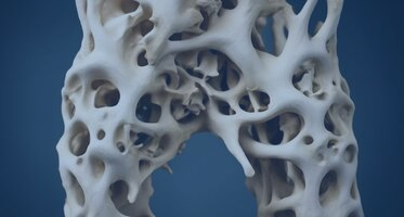 Профилактика остеопороза
